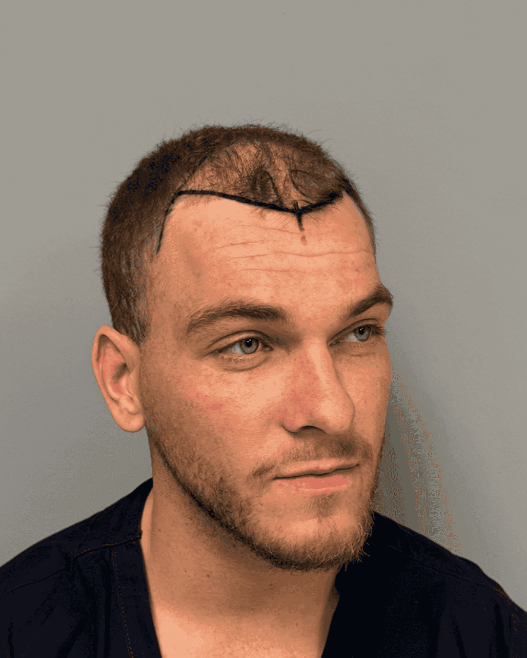 Resultat for Benjamin - før