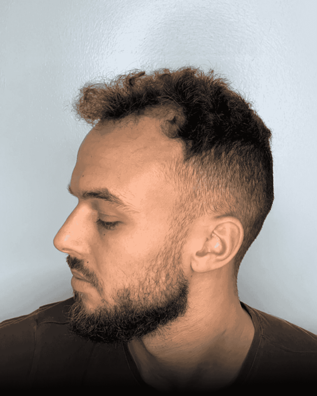 Resultat for Clark - før