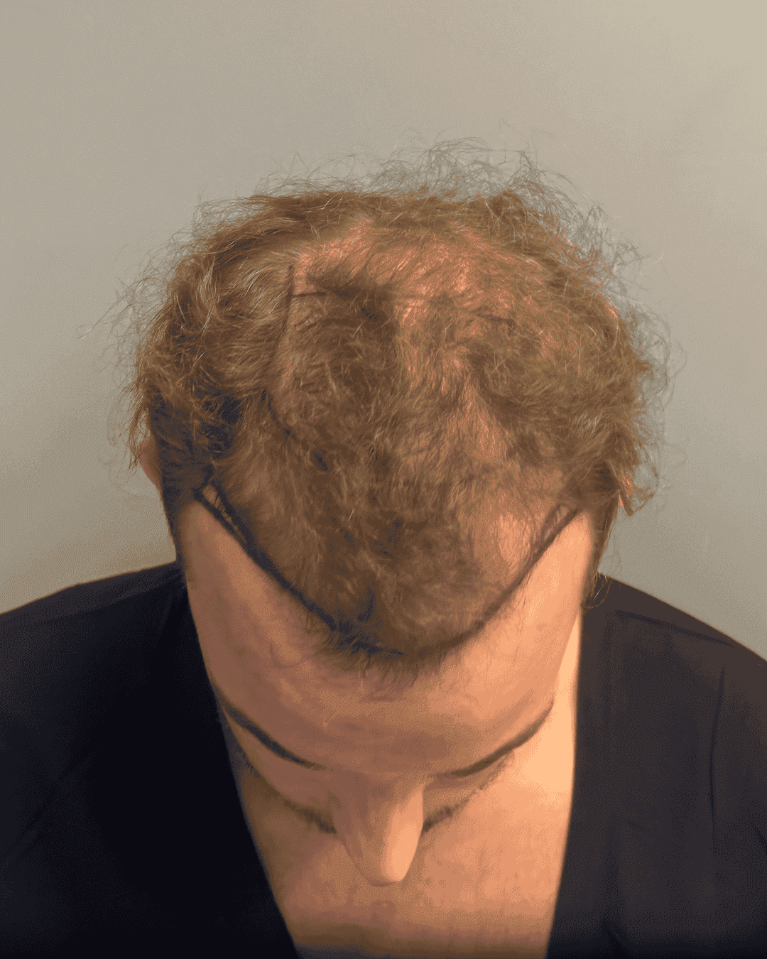 Resultat for Marco - før